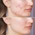 DERMATOLOGISCHE INFORMATIONEN!