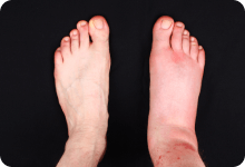 Warning symptoms image